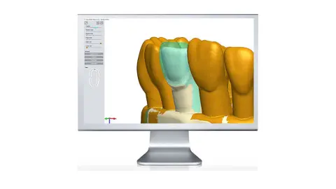 Modul MasterPREP – vizualizácia ukážkových preparácií v Dental Teacher