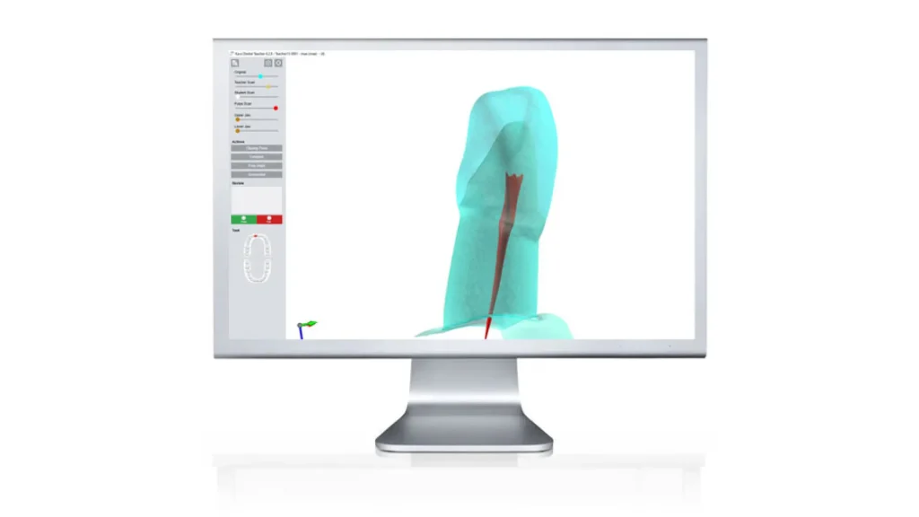 Zobrazenie pulpy v doplnkovom module – KaVo Dental Teacher