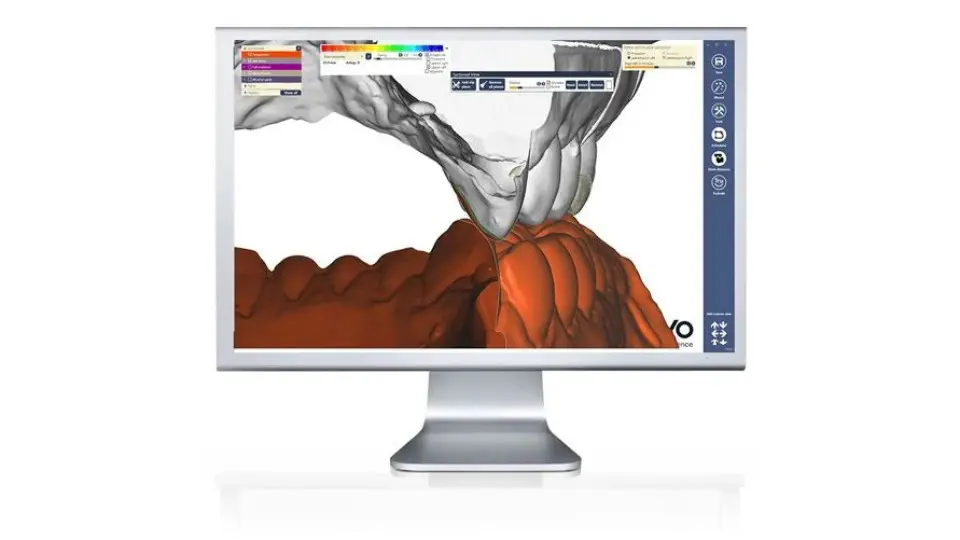 Virtuálny artikulátor KaVo – realistická simulácia pohybov čeľuste