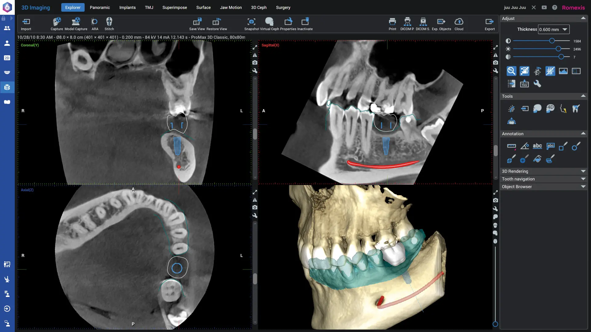 KaVo Romexis VR – realistická 3D diagnostika s jednoduchým ovládaním