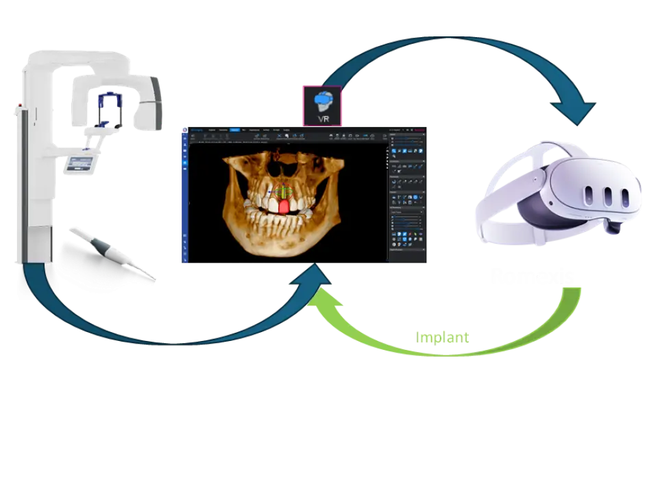 KaVo Romexis VR – plánovanie implantátov vo virtuálnej realite